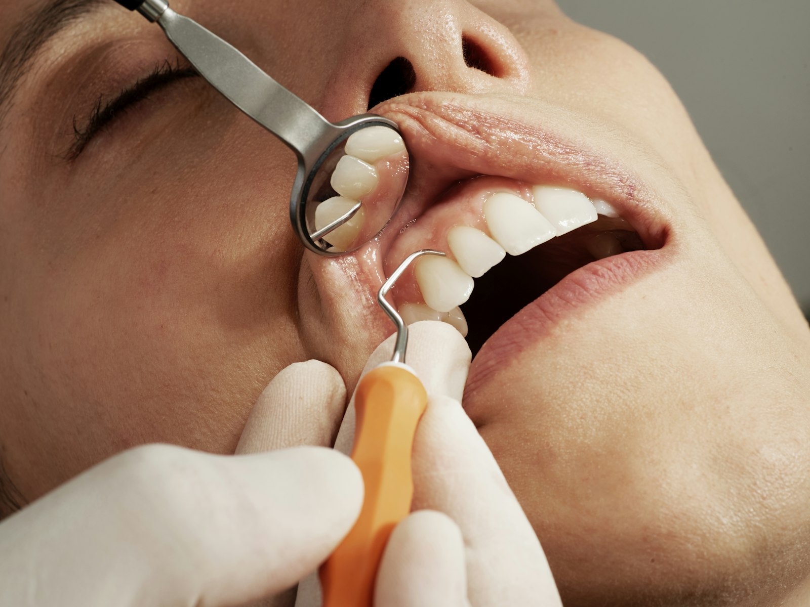Gum Contouring